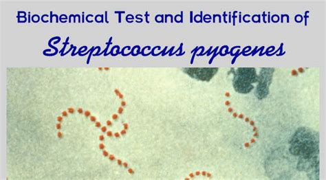 streptococcus biochemical test
